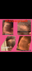 Forever Growth Hair Oil